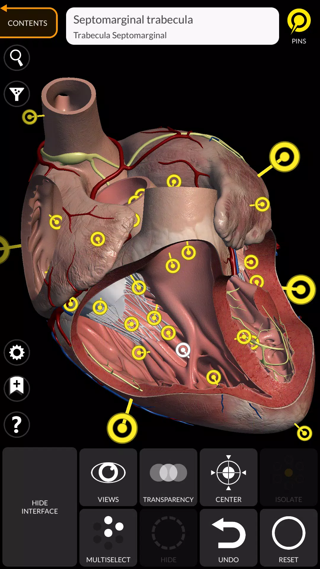 Schermata Anatomy 3D Atlas 2